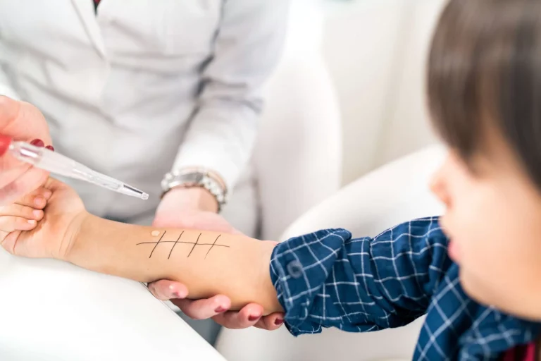 Allergy Testing in Children