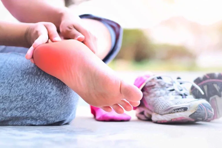 Causes of Heel Pain in Runners
