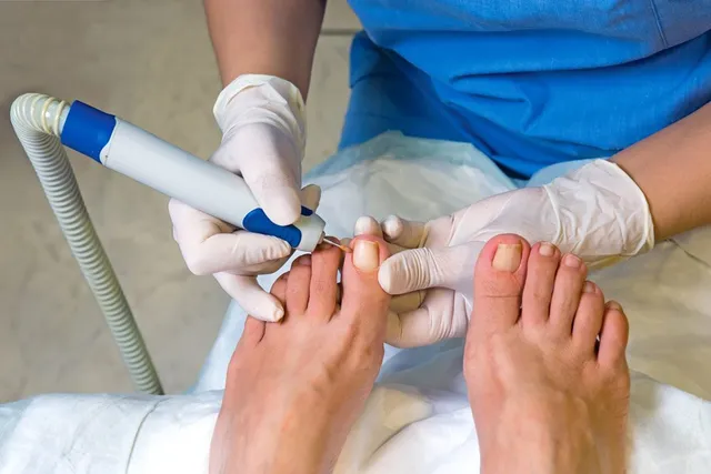 Understanding the Symptoms and Treatment Options for Ingrown Toenails Ingrown Toenails