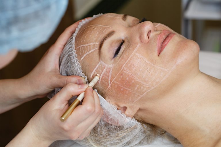 Methods for Skin Rejuvenation