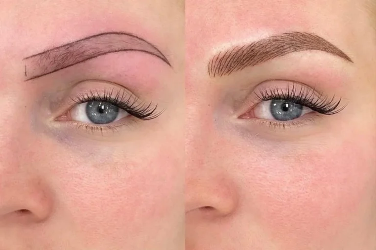 FAQs About Microblading