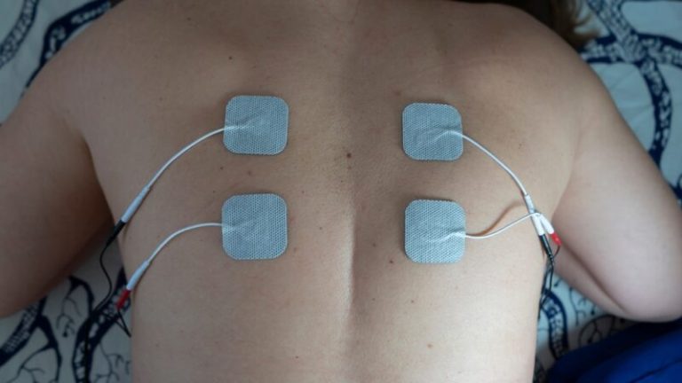Spinal Cord Stimulation