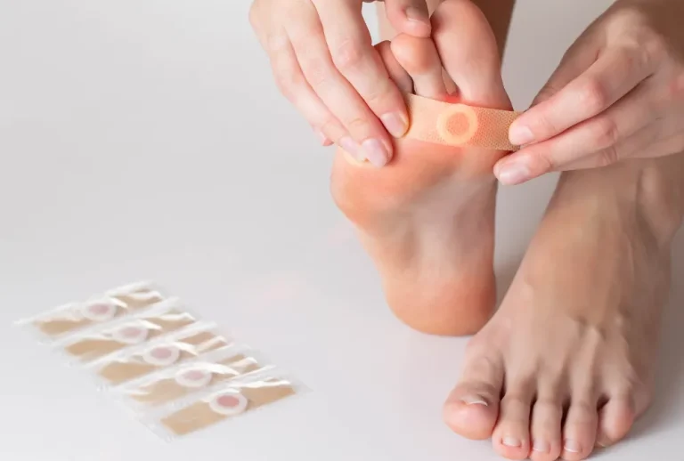 Wart Treatment Options and Prevention