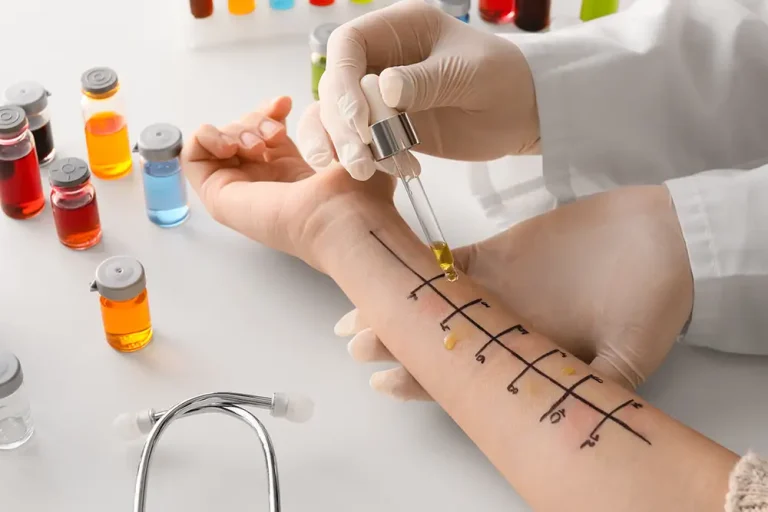 Allergy Testing
