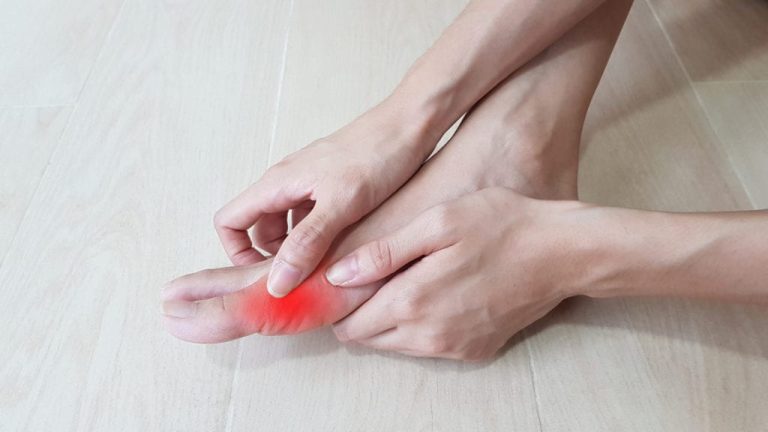 Lifestyle Changes and Treatments for Managing Bunions Treatments for Managing Bunions