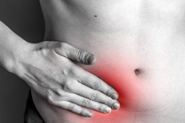 When Should You See a Surgeon for a Hernia? Hernia