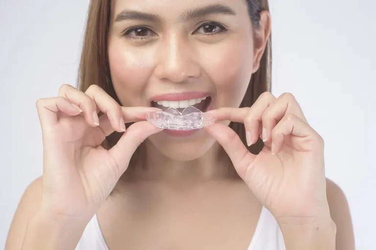 How Invisalign Can Help Correct Teeth Alignment Issues Invisalign