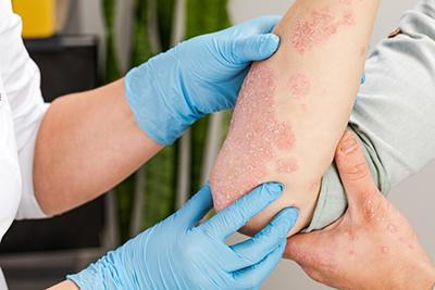 The Role of a Dermatologist in Managing Skin Conditions Role of a Dermatologist in Managing Skin Conditions