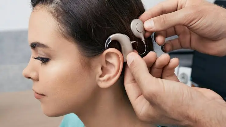 How Hearing Implants Improve Your Well-Being Hearing Implants