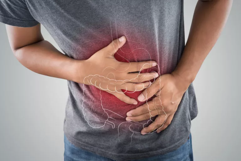 The Role of a Gastroenterologist in Treating Inflammatory Bowel Disease Inflammatory Bowel Disease