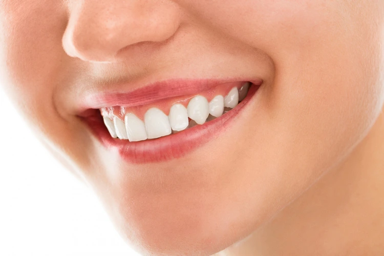 The Role of Teeth Whitening in Your Overall Oral Hygiene Routine Role of Teeth Whitening